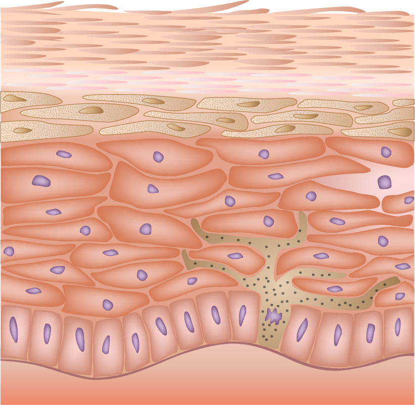 Basic Anatomy and Physiology of the Skin Medline